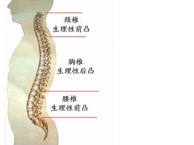 腰反弓|腰椎反弓能恢复吗